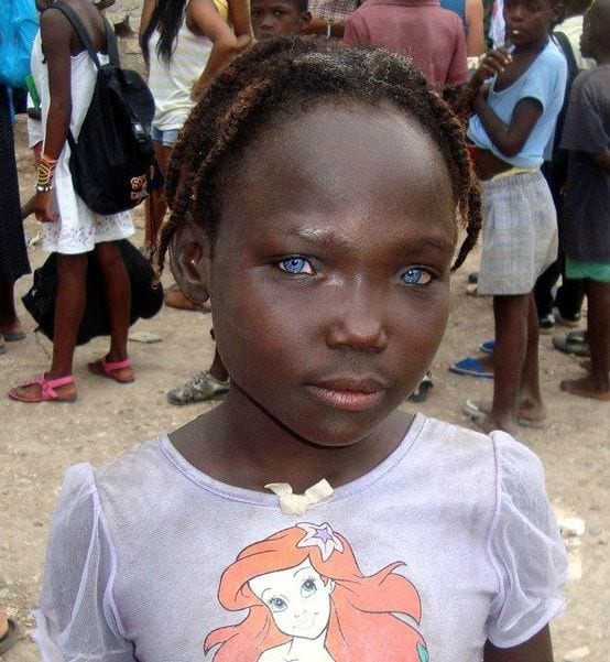20 Amazing Pictures of Black People with Blue Eyes