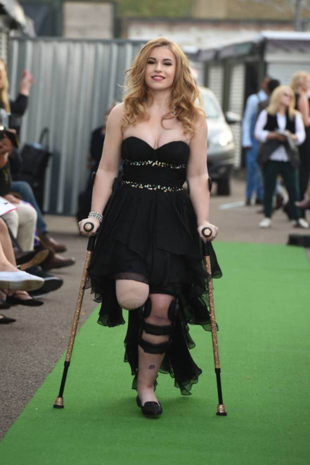 Top 10 Disabled Female Models From World You Must Know