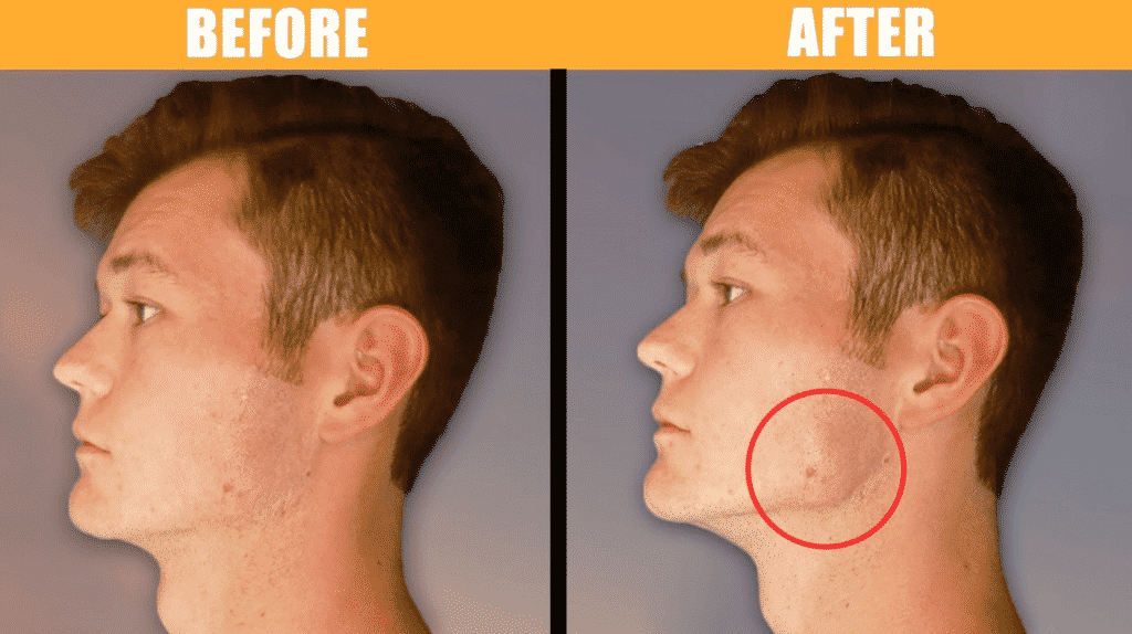 How To Get A Chiseled Jawline 20+ Exercises Tools To Use